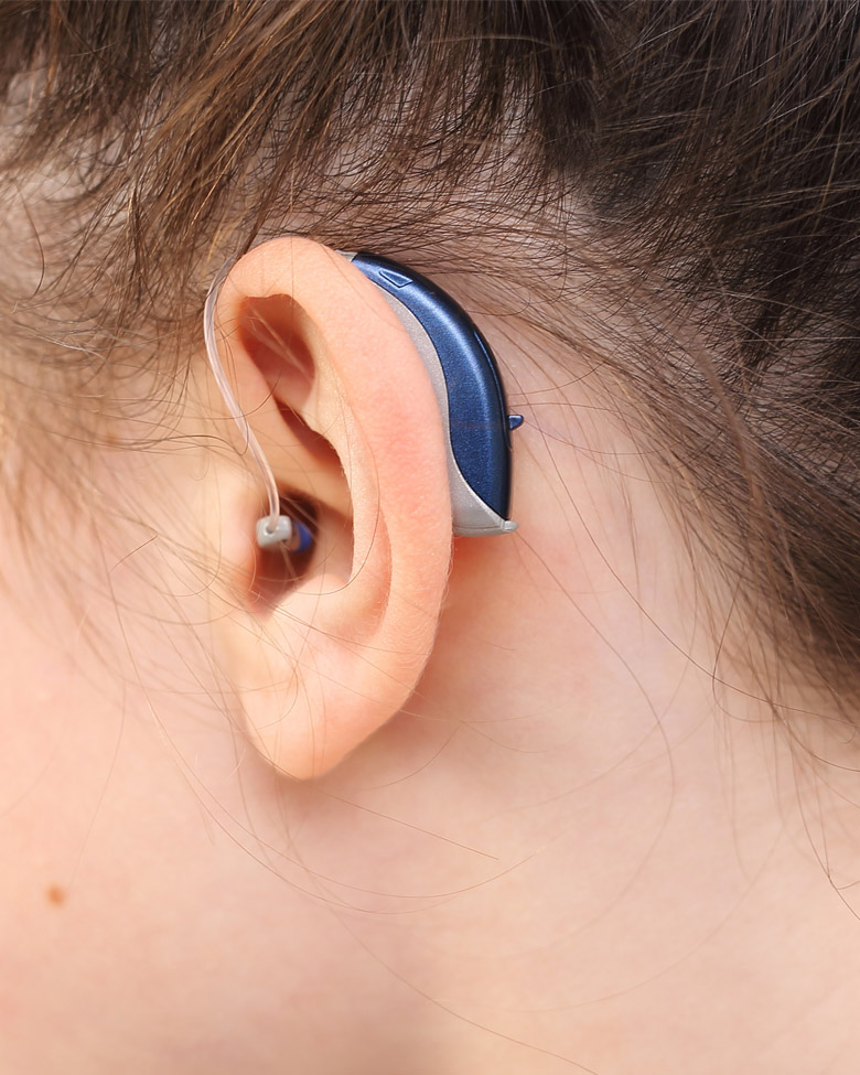 Exemple d appareil auditif contour d oreille