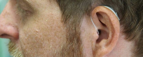 prothèse auditive à lyon
